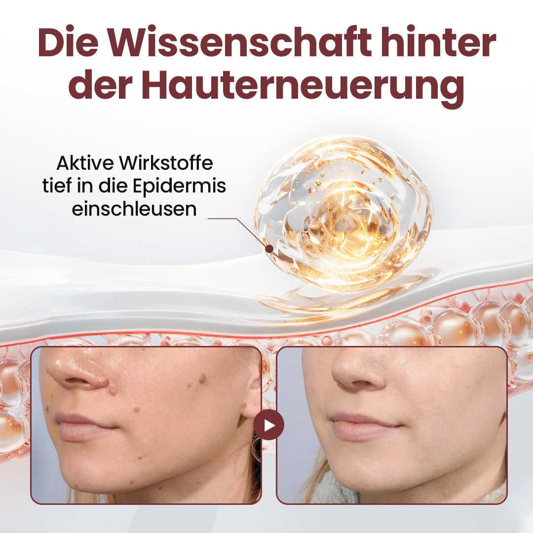 𝘼𝙥𝙝𝙞𝙣𝙚® 𝙆𝙚𝙧𝙖𝙀𝙧𝙖𝙨𝙚 𝘿𝙪𝙖𝙡-𝘼𝙘𝙩𝙞𝙤𝙣 𝙀𝙧𝙣𝙚𝙪𝙚𝙧𝙪𝙣𝙜𝙨𝙘𝙧𝙚𝙢𝙚 🇩🇪 ꜱᴀɴꜰᴛᴇ ᴇɴᴛꜰᴇʀɴᴜɴɢ ᴠᴏɴ ʜᴀᴜᴛᴀɴʜÄɴɢꜱᴇʟɴ ᴜɴᴅ ꜰʟᴇᴄᴋᴇɴ ɪɴ 7 ᴛᴀɢᴇɴ