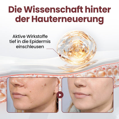 𝘼𝙥𝙝𝙞𝙣𝙚® 𝙆𝙚𝙧𝙖𝙀𝙧𝙖𝙨𝙚 𝘿𝙪𝙖𝙡-𝘼𝙘𝙩𝙞𝙤𝙣 𝙀𝙧𝙣𝙚𝙪𝙚𝙧𝙪𝙣𝙜𝙨𝙘𝙧𝙚𝙢𝙚 🇩🇪 ꜱᴀɴꜰᴛᴇ ᴇɴᴛꜰᴇʀɴᴜɴɢ ᴠᴏɴ ʜᴀᴜᴛᴀɴʜÄɴɢꜱᴇʟɴ ᴜɴᴅ ꜰʟᴇᴄᴋᴇɴ ɪɴ 7 ᴛᴀɢᴇɴ