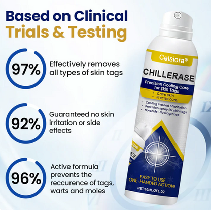 ❤️ Celsiora® ChillErase Kühlspray für Hautanhängsel 🇩🇪