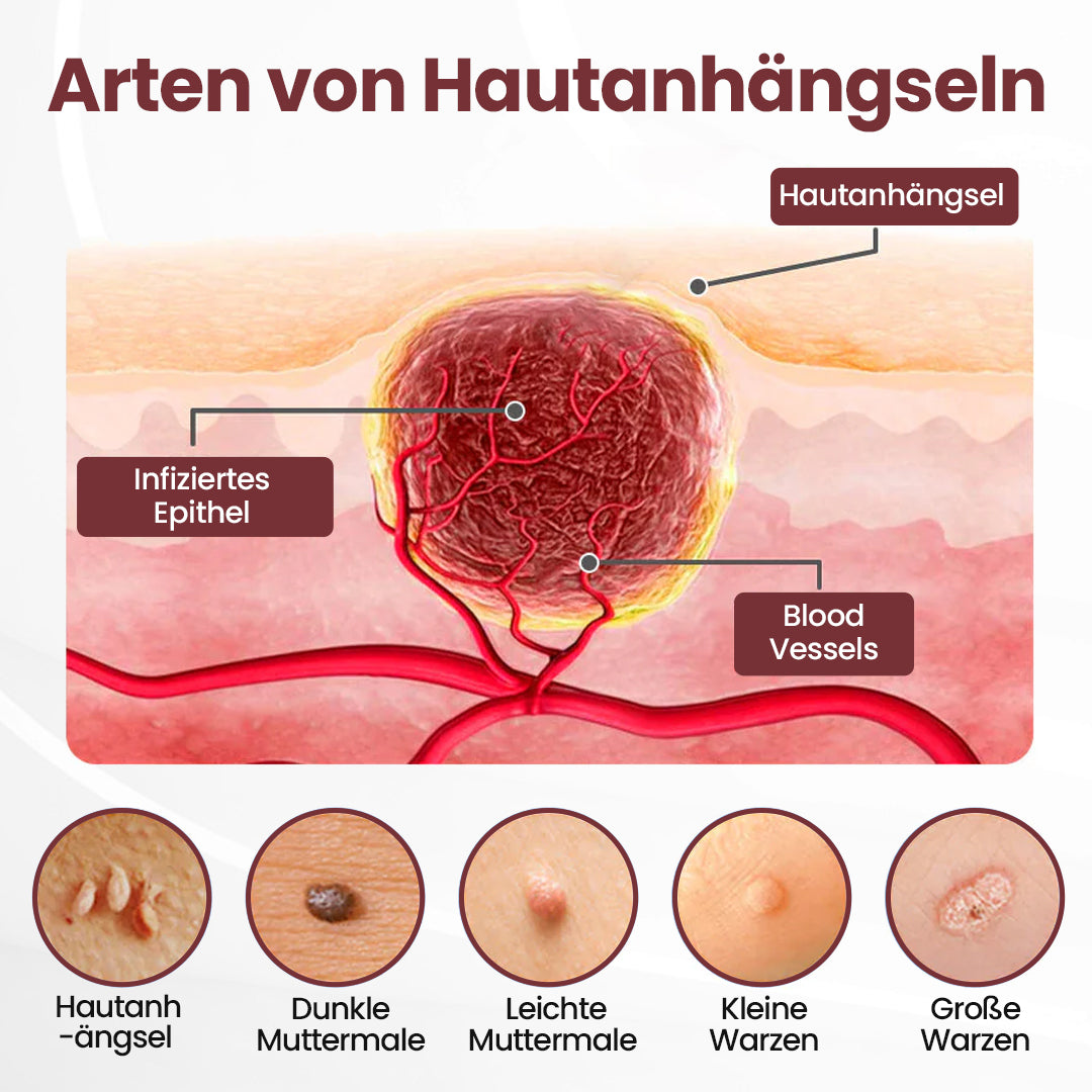 𝘼𝙥𝙝𝙞𝙣𝙚® 𝙆𝙚𝙧𝙖𝙀𝙧𝙖𝙨𝙚 𝘿𝙪𝙖𝙡-𝘼𝙘𝙩𝙞𝙤𝙣 𝙀𝙧𝙣𝙚𝙪𝙚𝙧𝙪𝙣𝙜𝙨𝙘𝙧𝙚𝙢𝙚 🇩🇪 ꜱᴀɴꜰᴛᴇ ᴇɴᴛꜰᴇʀɴᴜɴɢ ᴠᴏɴ ʜᴀᴜᴛᴀɴʜÄɴɢꜱᴇʟɴ ᴜɴᴅ ꜰʟᴇᴄᴋᴇɴ ɪɴ 7 ᴛᴀɢᴇɴ