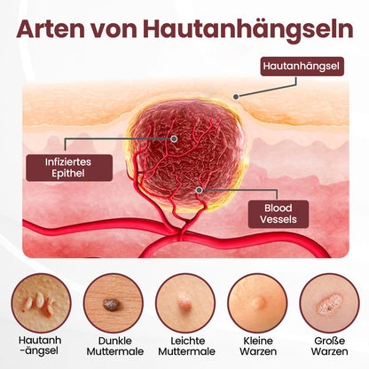 𝘼𝙥𝙝𝙞𝙣𝙚® 𝙆𝙚𝙧𝙖𝙀𝙧𝙖𝙨𝙚 𝘿𝙪𝙖𝙡-𝘼𝙘𝙩𝙞𝙤𝙣 𝙀𝙧𝙣𝙚𝙪𝙚𝙧𝙪𝙣𝙜𝙨𝙘𝙧𝙚𝙢𝙚 🇩🇪 ꜱᴀɴꜰᴛᴇ ᴇɴᴛꜰᴇʀɴᴜɴɢ ᴠᴏɴ ʜᴀᴜᴛᴀɴʜÄɴɢꜱᴇʟɴ ᴜɴᴅ ꜰʟᴇᴄᴋᴇɴ ɪɴ 7 ᴛᴀɢᴇɴ