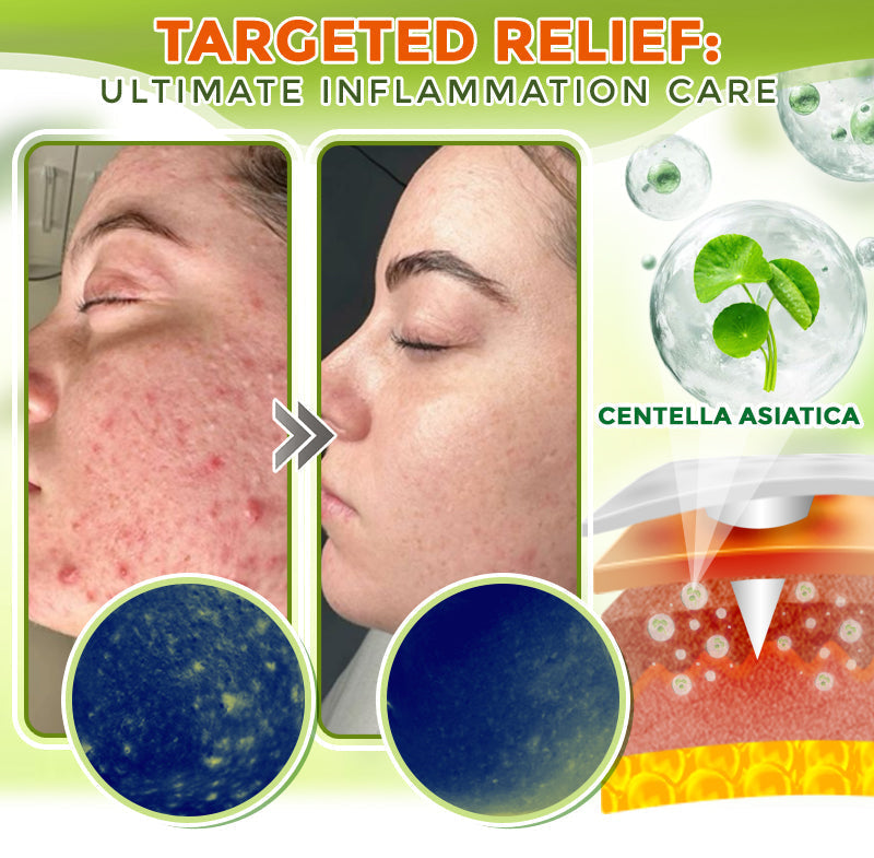 GFOUK® Umfassendes Mikronadel-Pflaster