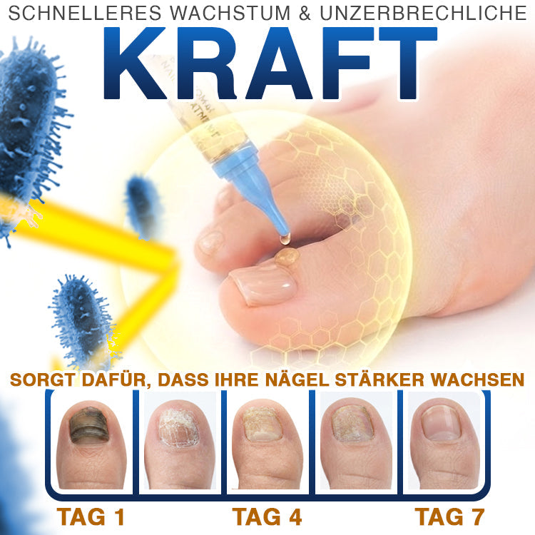🇩🇪 CareBreeze® Fungi Free Bienengift-Nagelbehandlung 🧑‍⚕️