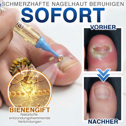 🇩🇪 CareBreeze® Fungi Free Bienengift-Nagelbehandlung 🧑‍⚕️