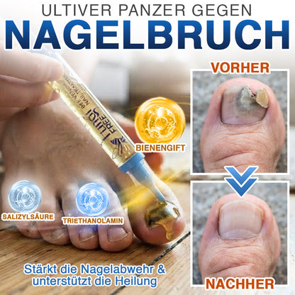 🇩🇪 CareBreeze® Fungi Free Bienengift-Nagelbehandlung 🧑‍⚕️