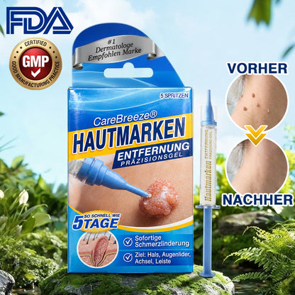 🇩🇪 CareBreeze® Anti-Stielwarzen-Präzisionsgel 🥼