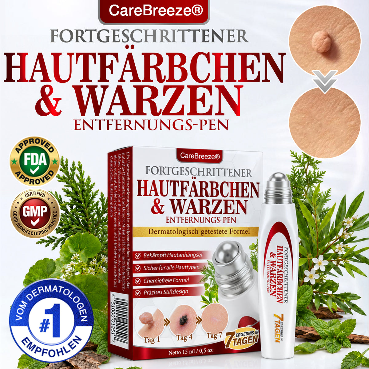 ✅ CareBreeze® Kräuter Stielwarzen- und Warzenentferner Roller