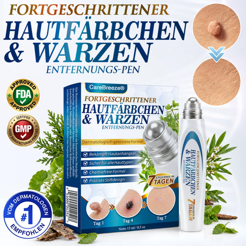🇩🇪 CareBreeze® Fortschrittlicher Stielwarzen- & Warzenentfernerstift 🧑🏼‍⚕️