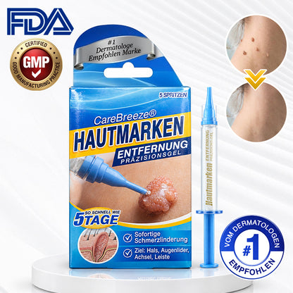 🇩🇪 CareBreeze® Anti-Stielwarzen-Präzisionsgel 🧑🏻‍⚕️🥼