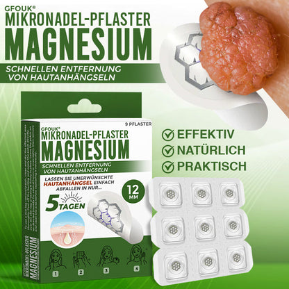 GFOUK® Magnesium Mikronadel-Pflaster zur schnellen Entfernung von Stielwarzen 🇩🇪 Hergestellt in Deutschland