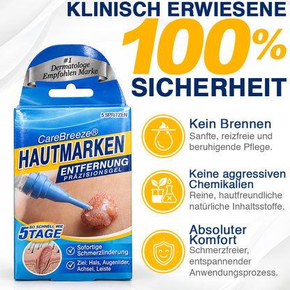 🇩🇪 CareBreeze® Anti-Stielwarzen-Präzisionsgel 🥼