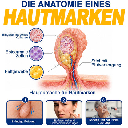 🇩🇪 CareBreeze® Anti-Stielwarzen-Präzisionsgel 🥼