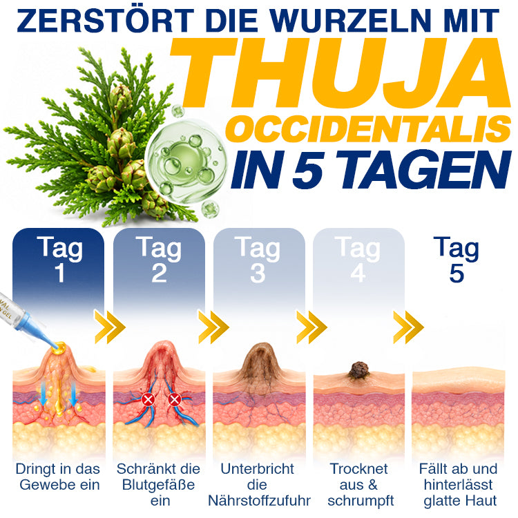 🇩🇪 CareBreeze® Anti-Stielwarzen-Präzisionsgel 🥼