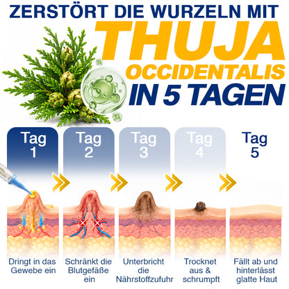 🇩🇪 CareBreeze® Anti-Stielwarzen-Präzisionsgel 🥼