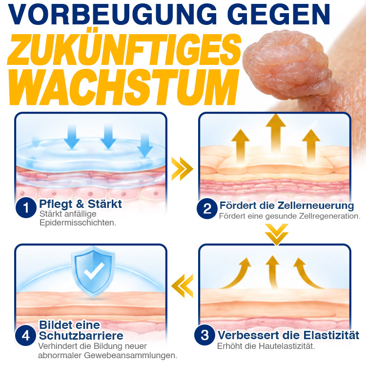 🇩🇪 CareBreeze® Anti-Stielwarzen-Präzisionsgel 🥼