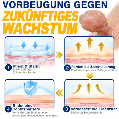🇩🇪 CareBreeze® Anti-Stielwarzen-Präzisionsgel 🥼