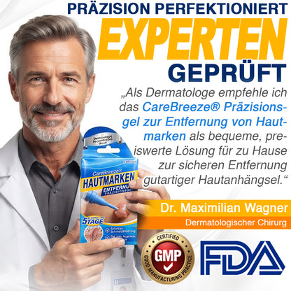 🇩🇪 CareBreeze® Anti-Stielwarzen-Präzisionsgel 🥼