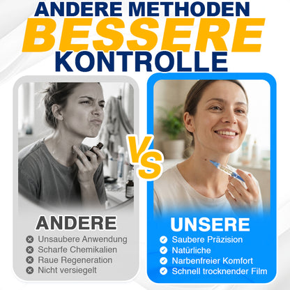 🇩🇪 CareBreeze® Anti-Stielwarzen-Präzisionsgel 🥼