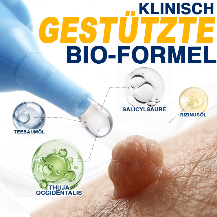 🇩🇪 CareBreeze® Anti-Stielwarzen-Präzisionsgel 🥼