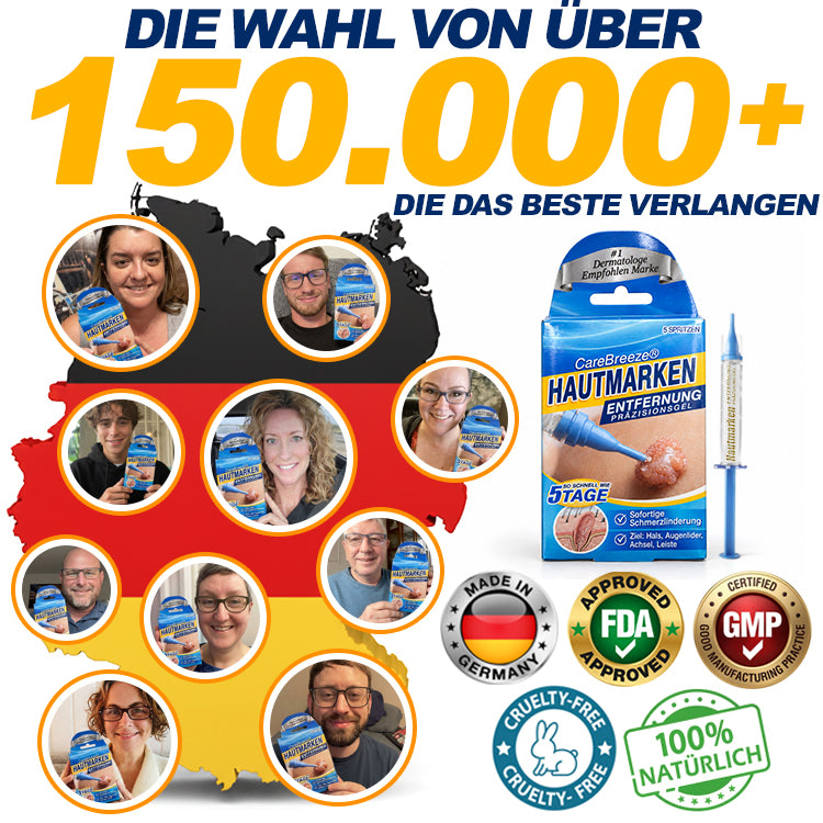 🇩🇪 CareBreeze® Anti-Stielwarzen-Präzisionsgel 🥼