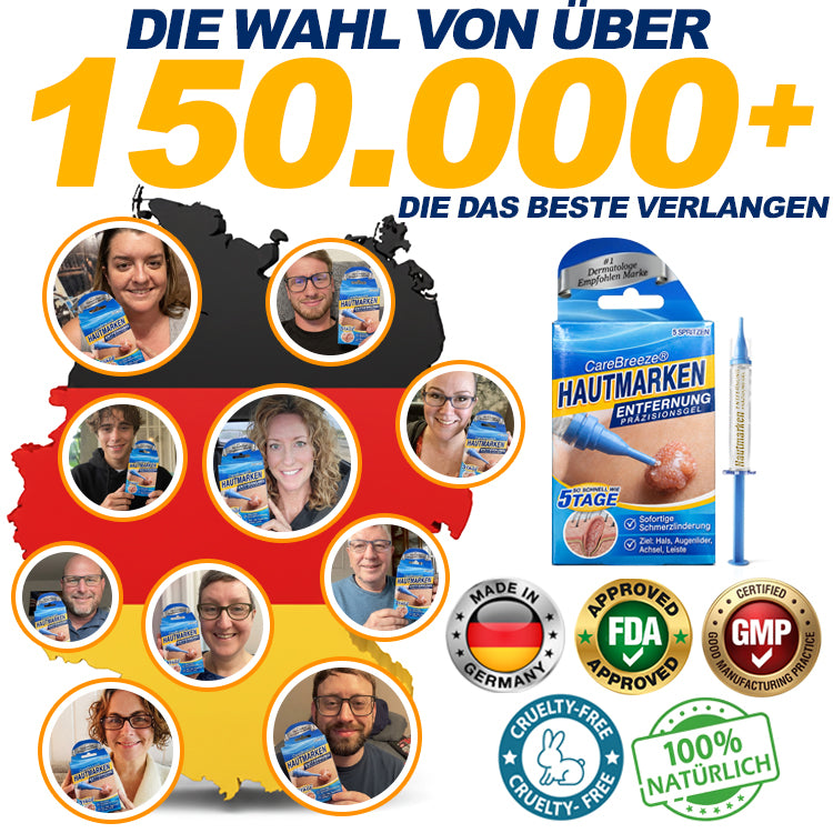 🇩🇪 CareBreeze® Anti-Stielwarzen-Präzisionsgel 🧑🏻‍⚕️🥼