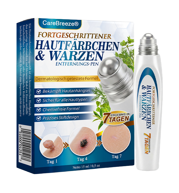 🇩🇪 CareBreeze® Fortschrittlicher Stielwarzen- & Warzenentfernerstift 🧑🏼‍⚕️
