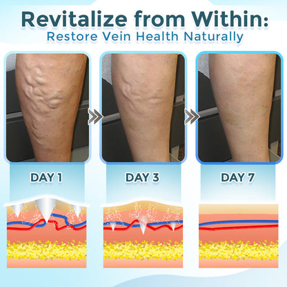 GFOUK® VenaRestore Mikronadel-Pflaster zur Venenreparatur