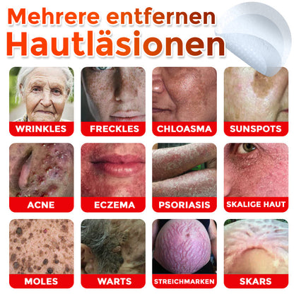 🇩🇪👨🏻‍⚕️ GFOUK® Mikronadel-Botanisches Hautanhängsel-Entfernungspflaster ✅