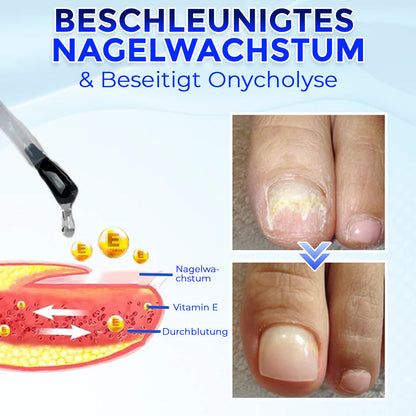 Aphine® OnyxoGuard Serum für Nagelwachstum & Nagelreparatur 🇩🇪