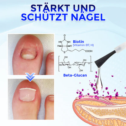 Aphine® OnyxoGuard Serum für Nagelwachstum & Nagelreparatur 🇩🇪