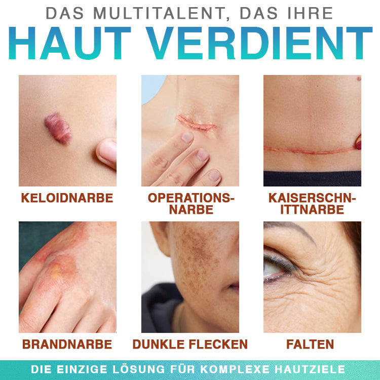 CareBreeze® Mikronadel-Pflaster zur Narbenpflege