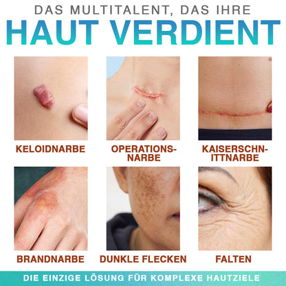 CareBreeze® Mikronadel-Pflaster zur Narbenpflege