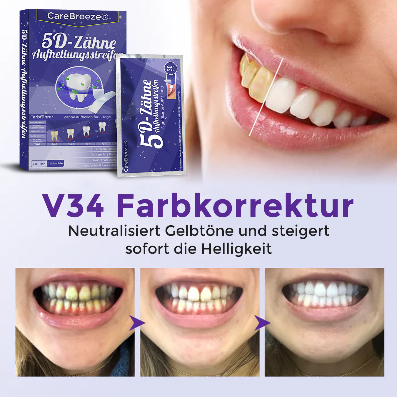 CareBreeze® 5D Zahnaufhellungsstreifen 🇩🇪
