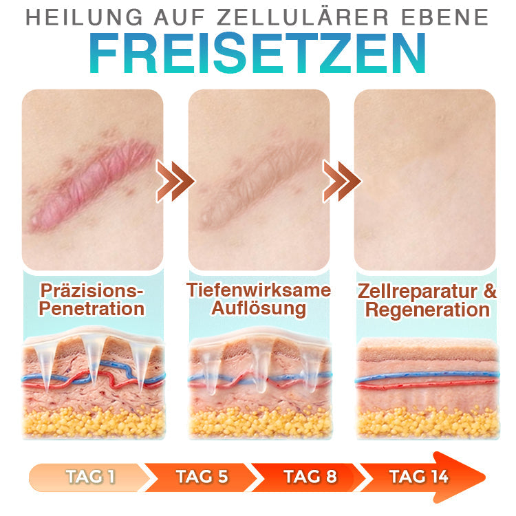 CareBreeze® Mikronadel-Pflaster zur Narbenpflege