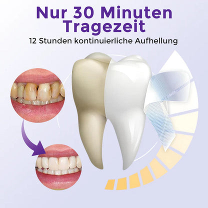 CareBreeze® 5D Zahnaufhellungsstreifen 🇩🇪