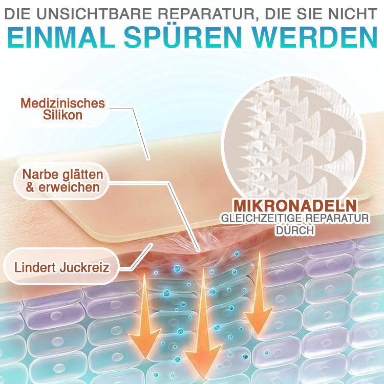 CareBreeze® Mikronadel-Pflaster zur Narbenpflege
