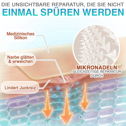CareBreeze® Mikronadel-Pflaster zur Narbenpflege