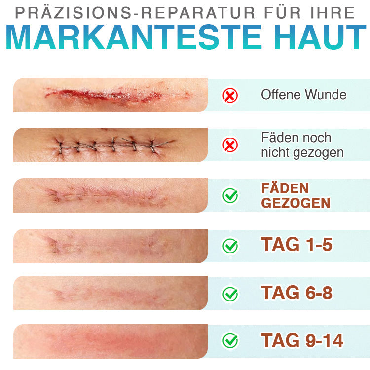 CareBreeze® Mikronadel-Pflaster zur Narbenpflege