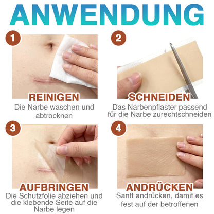 CareBreeze® Mikronadel-Pflaster zur Narbenpflege