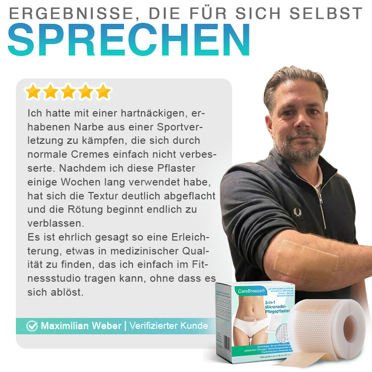 CareBreeze® Mikronadel-Pflaster zur Narbenpflege
