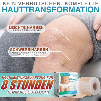CareBreeze® Mikronadel-Pflaster zur Narbenpflege