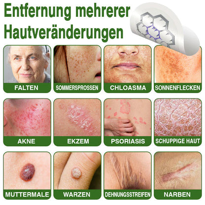 GFOUK® Magnesium Mikronadel-Pflaster zur schnellen Entfernung von Stielwarzen 🇩🇪 Hergestellt in Deutschland