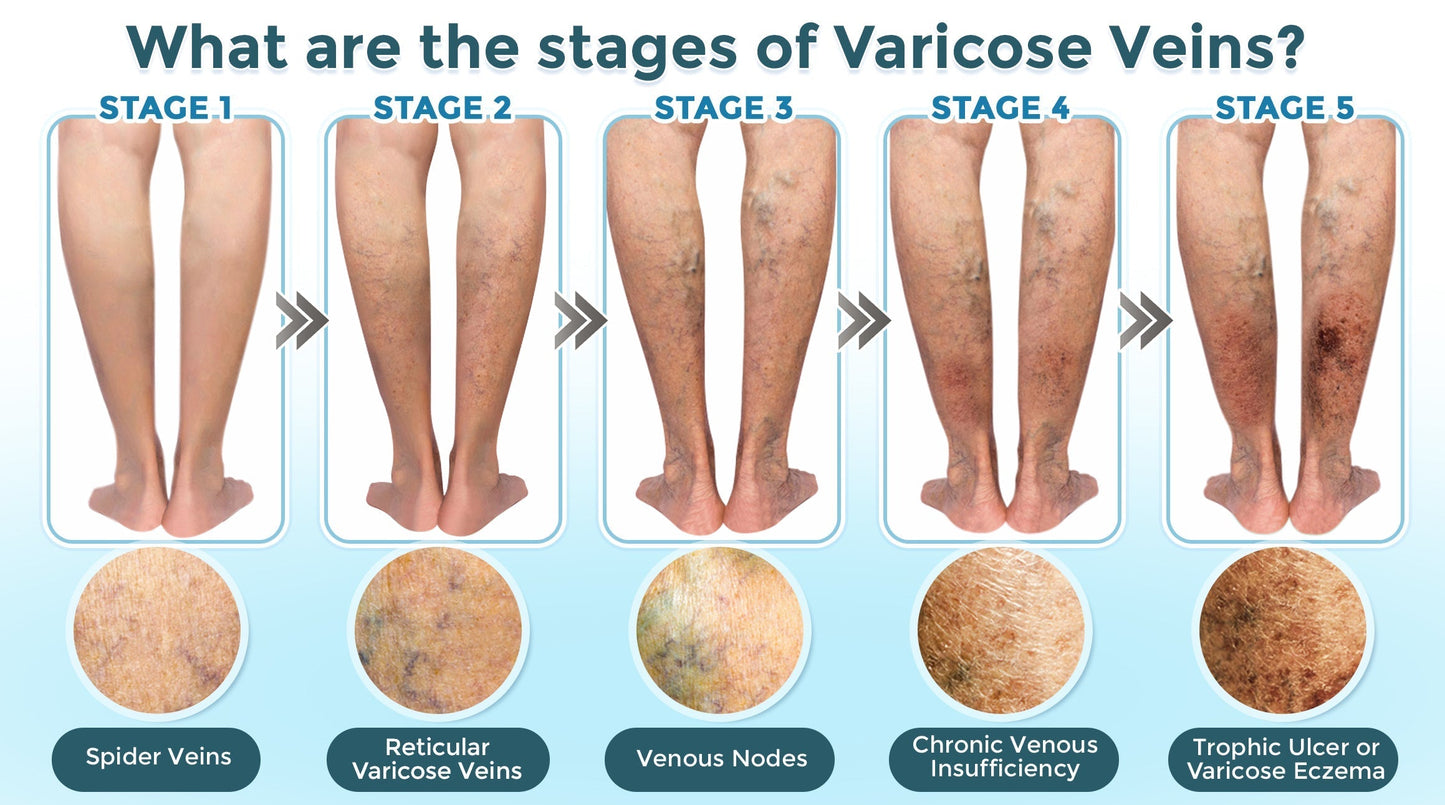 GFOUK® VenaRestore Mikronadel-Pflaster zur Venenreparatur