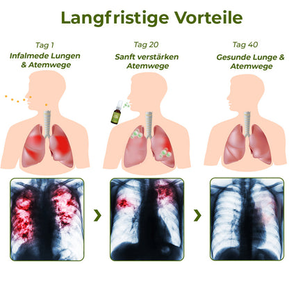 GFOUK® BreathDetox Kräuter-Lungenreinigungsspray 🫁